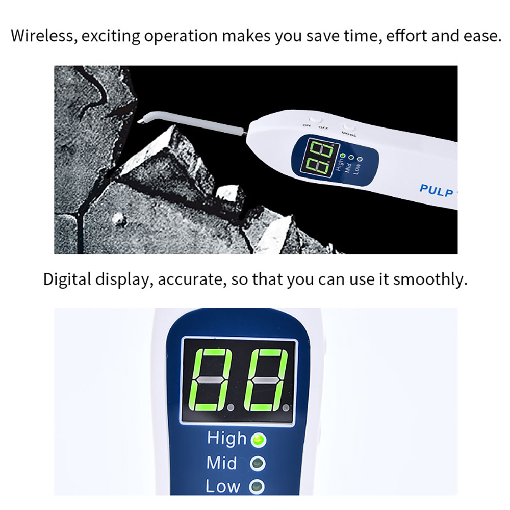 Nuovo Dentale Endodonzia Pulpa - Electronics Quiz recensione e prezzo